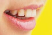 Kývání zubů: Jaké jsou příčiny (v dospělosti i u dětí)?