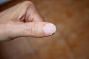 Lámavé nehty a jejich hlavní příčiny? Jak se s nimi dá bojovat?