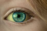 Z čeho mohou být žlutá bělma očí?